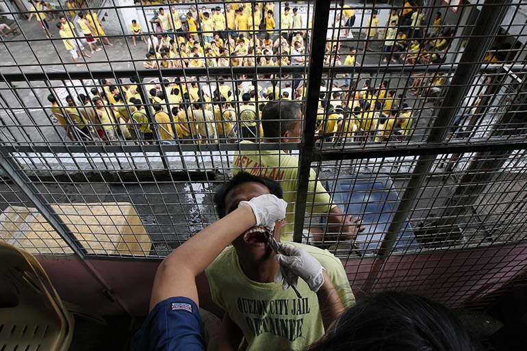 Tooth extraction in a Philippine prison