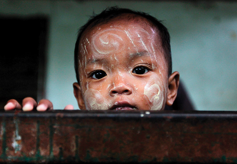 a Burmese Karen child waits for treatment at a medical clinic in a Thai border camp