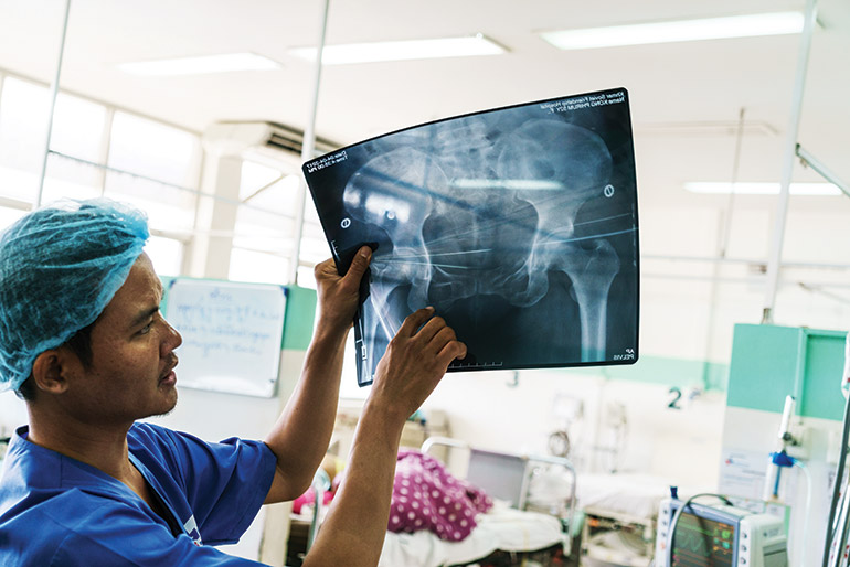 A doctor checks an X-ray of a pelvis at the Khmer Soviet Friendship. Photo: Sam Jam