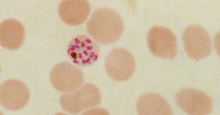 Plasmodium falciparum_malaria_deadly_humans_Southeast Asia Globe 2019