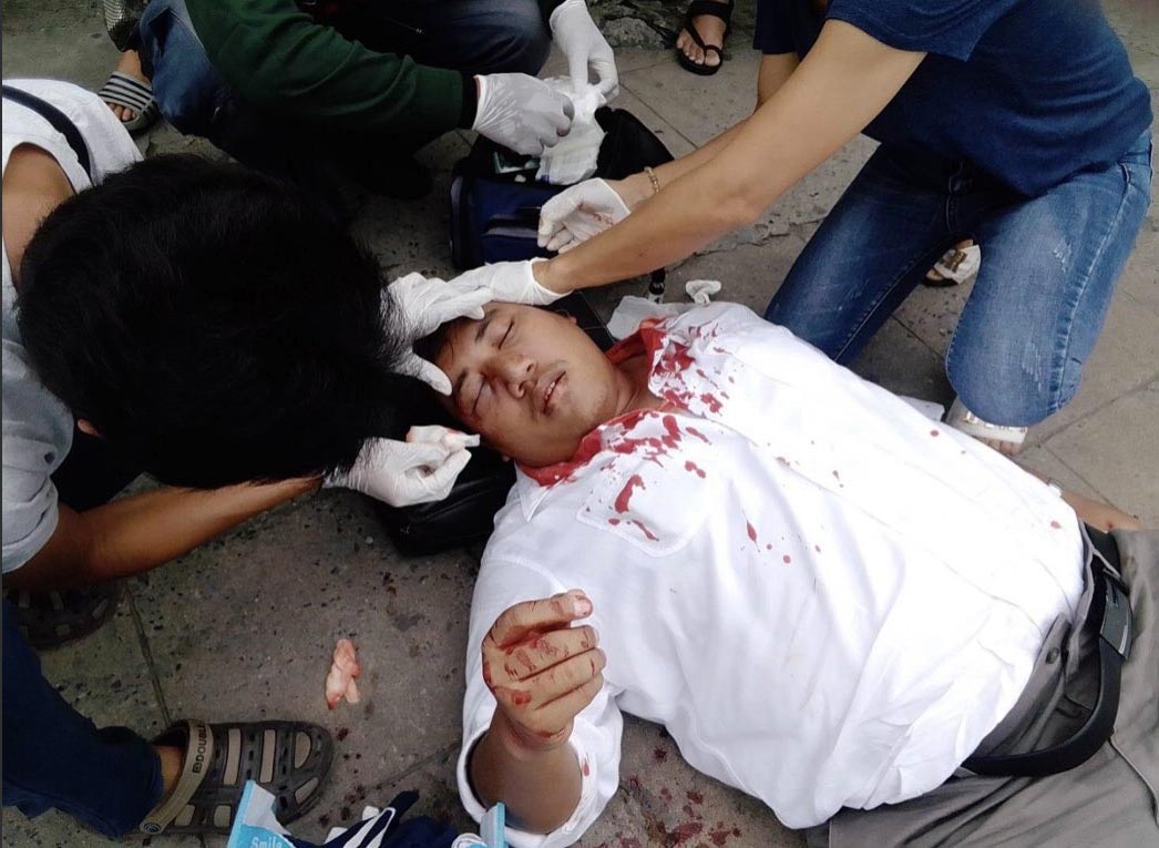 Thai pro-democracy activist Ja New was beaten by masked thugs last week.