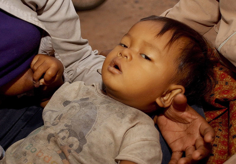 One-year-old malaria patient Heang Thearot held by his mother at clinic in Preah Vihear province in Cambodia's west, before the boy was moved to a hospital in Siem Reap due to lack of treatment facilities locally. Photo: EPA/Heng Sinith